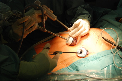 endoskopie-besteck